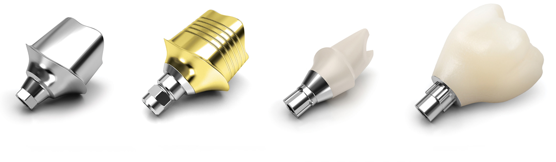 ArgenIS Custom Abutment design and manufacturing