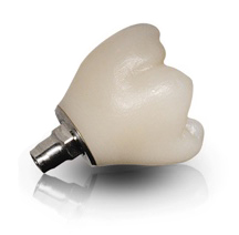 Screw Retained Full Contour Custom Abutment