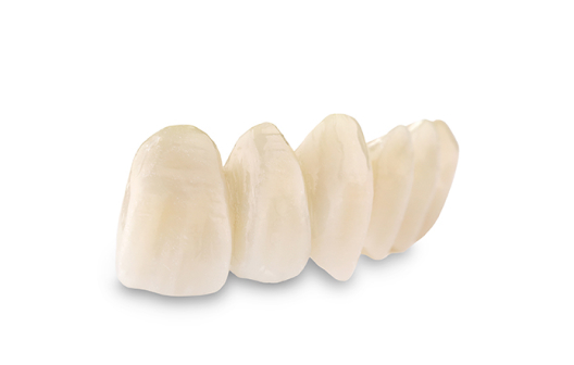 ArgenZ HT+ Multilayer Zirconia milled 4-unit bridge